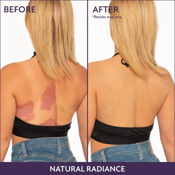 🔥Last day buy 1 get 1 free! 🎁All-in-one moisturiser, concealer en dekking 💧✨ Lichtgewicht en waterproof