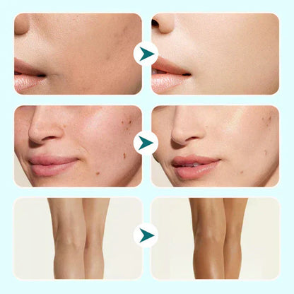 🔥Last day buy 1 get 1 free! 🎁All-in-one moisturiser, concealer en dekking 💧✨ Lichtgewicht en waterproof