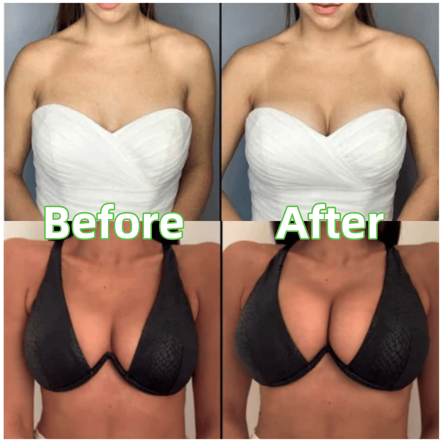 🔥Plakbeha-inleggers - Wasbaar & Herbruikbaar, Instant Lift🔥(Latexvrij en Allergievriendelijk)