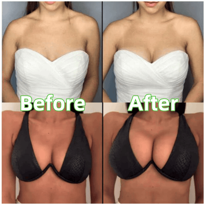 🔥Plakbeha-inleggers - Wasbaar & Herbruikbaar, Instant Lift🔥(Latexvrij en Allergievriendelijk)